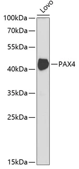 WB analysis of Lovo cell lysate using GTX64523 PAX4 antibody. The signal was developed with ECL plus-Enhanced. Dilution : 1:1000 Loading : 25microg per lane WB analysis of Lovo cell lysate using GTX64523 PAX4 antibody. The signal was developed with ECL plus-Enhanced. Dilution : 1:1000 Loading : 25microg per lane