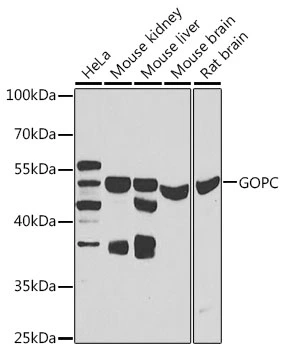 WB analysis of various sample lysates using GTX64526 PIST antibody. Dilution : 1:1000 Loading : 25microg per lane WB analysis of various sample lysates using GTX64526 PIST antibody. Dilution : 1:1000 Loading : 25microg per lane