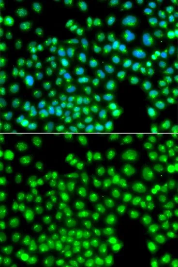 ICC/IF analysis of A549 cells using GTX64526 PIST antibody. Blue : DAPI