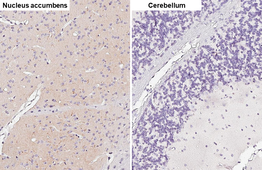 m.h様　確認用 Anti-MCH-1R antibody [HL5082] (GTX645272) | GeneTex