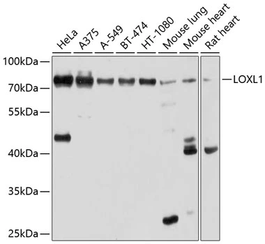 WB analysis of various sample lysates using GTX64529 LOXL1 antibody. Dilution : 1:1000 Loading : 25microg per lane WB analysis of various sample lysates using GTX64529 LOXL1 antibody. Dilution : 1:1000 Loading : 25microg per lane