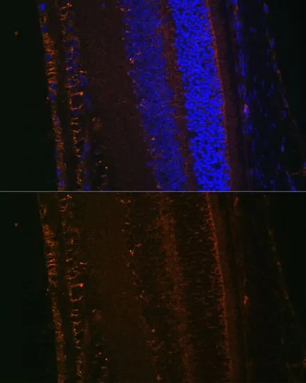 IHC-P analysis of mouse eye tissue using GTX64529 LOXL1 antibody. Blue : DAPI Dilution : 1:100