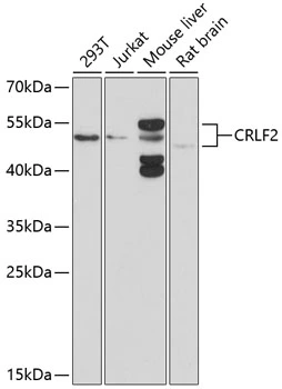 WB analysis of various sample lysates using GTX64541 CRLF2 antibody. Dilution : 1:1000 Loading : 25microg per lane WB analysis of various sample lysates using GTX64541 CRLF2 antibody. Dilution : 1:1000 Loading : 25microg per lane