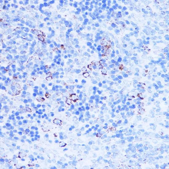 IHC-P analysis of rat spleen tissue using GTX64542 SHMT2 antibody. Dilution : 1:100