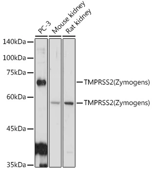 WB analysis of various sample lysates using GTX64544 TMPRSS2 antibody. Dilution : 1:1000 Loading : 25microg per lane