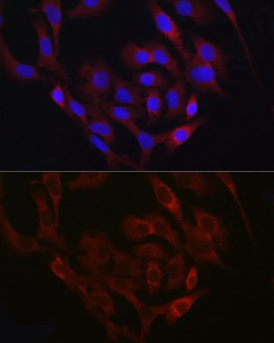 ICC/IF analysis of A549 cells using GTX64544 TMPRSS2 antibody. Blue : DAPI Dilution : 1:50