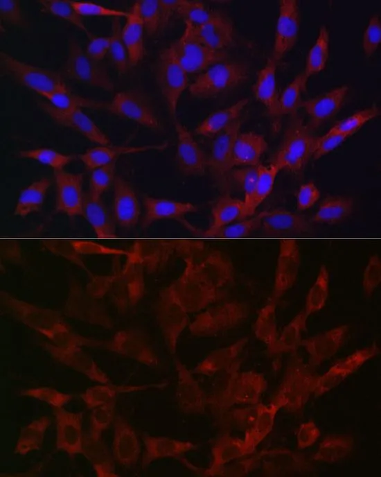 ICC/IF analysis of C6 cells using GTX64544 TMPRSS2 antibody. Blue : DAPI Dilution : 1:50