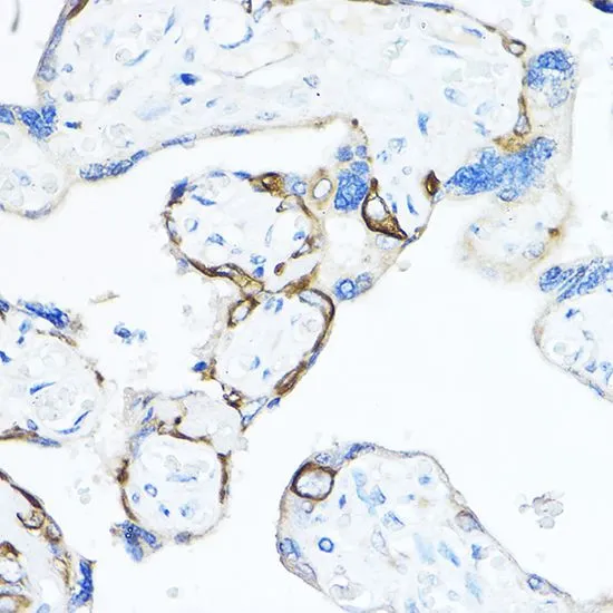 IHC-P analysis of human placenta tissue using GTX64544 TMPRSS2 antibody. Dilution : 1:50