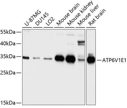 WB analysis of various sample lysates using GTX64545 ATP6V1E1 antibody. Dilution : 1:1000 Loading : 25microg per lane WB analysis of various sample lysates using GTX64545 ATP6V1E1 antibody. Dilution : 1:1000 Loading : 25microg per lane