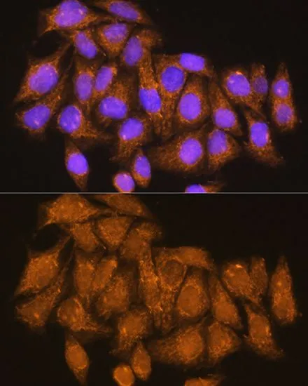 ICC/IF analysis of HeLa cells using GTX64545 ATP6V1E1 antibody. Blue : DAPI Dilution : 1:100