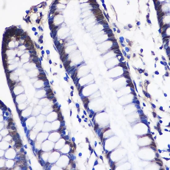 IHC-P analysis of human colon tissue using GTX64547 CUGBP1 antibody. Dilution : 1:100