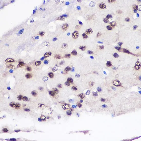 IHC-P analysis of mouse brain tissue using GTX64547 CUGBP1 antibody. Dilution : 1:100