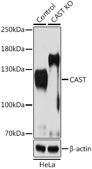 WB analysis of normal (control) and knockout (KO) HeLa cell lysate using GTX64549 Calpastatin antibody. Dilution : 1:1000 Loading : 25microg per lane WB analysis of normal (control) and knockout (KO) HeLa cell lysate using GTX64549 Calpastatin antibody. Dilution : 1:1000 Loading : 25microg per lane