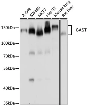 WB analysis of various sample lysates using GTX64549 Calpastatin antibody. Dilution : 1:1000 Loading : 25microg per lane