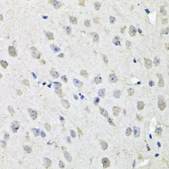 IHC-P analysis of mouse brain tissue using GTX64550 CHCHD3 antibody. Dilution : 1:100