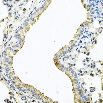IHC-P analysis of mouse lung tissue using GTX64550 CHCHD3 antibody. Dilution : 1:100