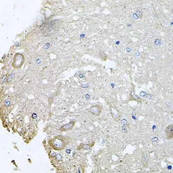 IHC-P analysis of rat brain tissue using GTX64550 CHCHD3 antibody. Dilution : 1:100
