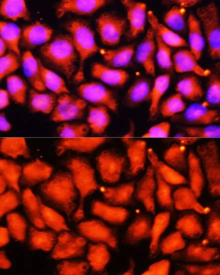 ICC/IF analysis of HeLa cells using GTX64557 ACADL antibody. Blue : DAPI Dilution : 1:100