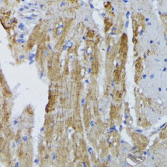 IHC-P analysis of mouse heart tissue using GTX64557 ACADL antibody. Dilution : 1:100