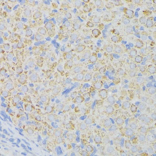 IHC-P analysis of rat ovary tissue using GTX64557 ACADL antibody. Dilution : 1:100