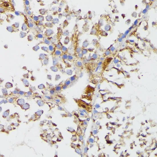 IHC-P analysis of mouse testis tissue using GTX64559 Galactosylceramidase antibody. Dilution : 1:100