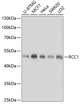 WB analysis of various sample lysates using GTX64560 RCC1 antibody. Dilution : 1:1000 Loading : 25microg per lane WB analysis of various sample lysates using GTX64560 RCC1 antibody. Dilution : 1:1000 Loading : 25microg per lane