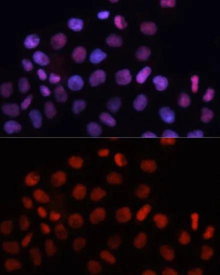 ICC/IF analysis of HeLa cells using GTX64560 RCC1 antibody. Blue : DAPI Dilution : 1:100