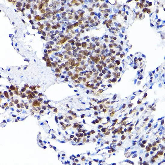 IHC-P analysis of mouse kidney tissue using GTX64560 RCC1 antibody. Dilution : 1:100