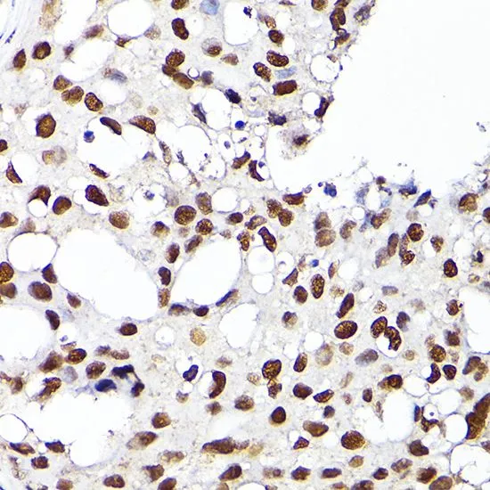 IHC-P analysis of rat lung tissue using GTX64560 RCC1 antibody. Dilution : 1:100
