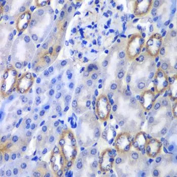 IHC-P analysis of mouse kidney tissue using GTX64561 MATK antibody. Dilution : 1:100