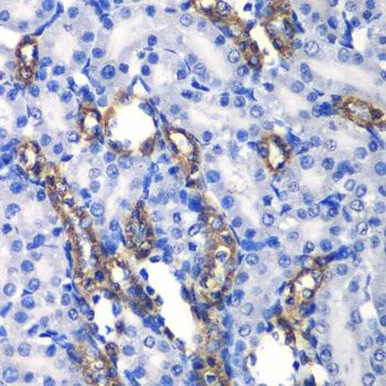 IHC-P analysis of rat kidney tissue using GTX64561 MATK antibody. Dilution : 1:100