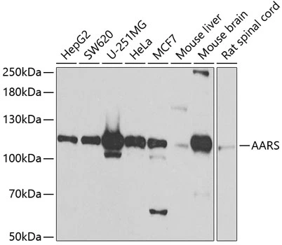 WB analysis of various sample lysates using GTX64565 alanyl-tRNA synthetase antibody. Dilution : 1:1000 Loading : 25microg per lane WB analysis of various sample lysates using GTX64565 alanyl-tRNA synthetase antibody. Dilution : 1:1000 Loading : 25microg per lane