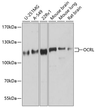 WB analysis of various samples using GTX64567 INPP5F antibody. Dilution : 1:1000 Loading : 25ug per lane