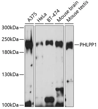WB analysis of various sample lysates using GTX64568 PHLPP1 antibody. Dilution : 1:1000 Loading : 25microg per lane WB analysis of various sample lysates using GTX64568 PHLPP1 antibody. Dilution : 1:1000 Loading : 25microg per lane