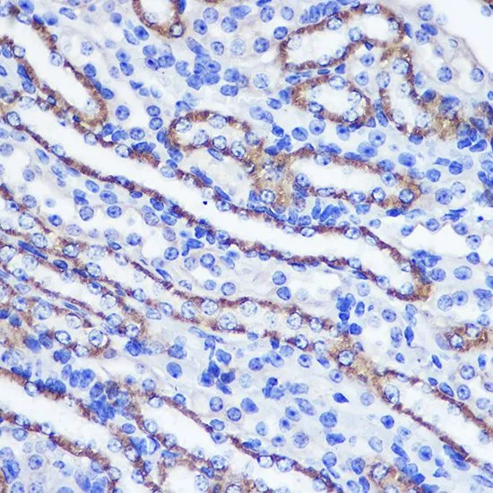 IHC-P analysis of mouse kidney tissue using GTX64568 PHLPP1 antibody. Dilution : 1:100