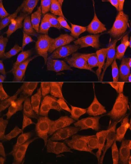 ICC/IF analysis of NIH/3T3 cells using GTX64571 AOX1 antibody. Blue : DAPI Dilution : 1:100