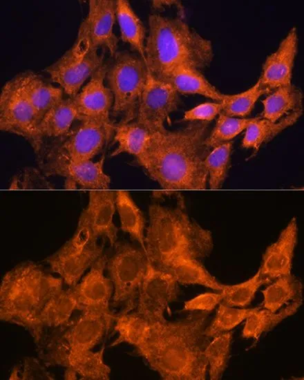 ICC/IF analysis of C6 cells using GTX64571 AOX1 antibody. Blue : DAPI Dilution : 1:100