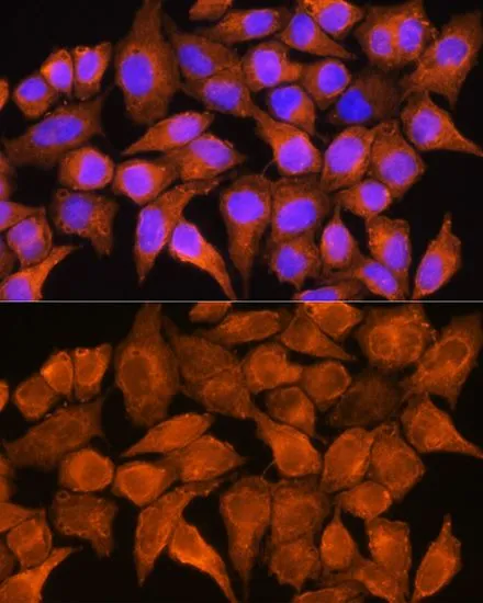 ICC/IF analysis of HeLa cells using GTX64571 AOX1 antibody. Blue : DAPI Dilution : 1:100