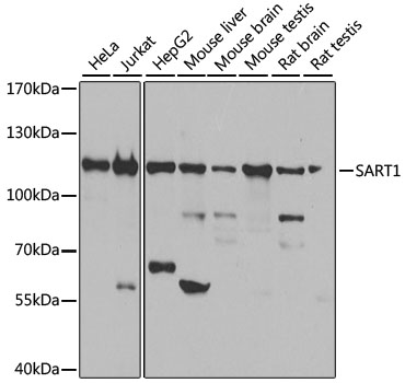 WB analysis of various samples using GTX64573 SART1 antibody. Dilution : 1:1000 Loading : 25ug per lane