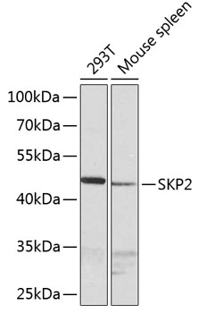 WB analysis of various sample lysates using GTX64578 SKP2 antibody. Dilution : 1:1000 Loading : 25microg per lane WB analysis of various sample lysates using GTX64578 SKP2 antibody. Dilution : 1:1000 Loading : 25microg per lane