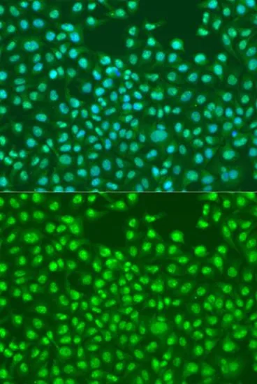 ICC/IF analysis of U2OS cells using GTX64578 SKP2 antibody. Blue : DAPI Dilution : 1:100