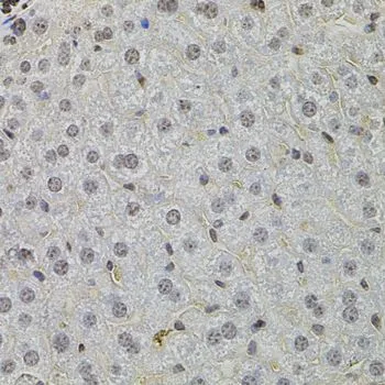 IHC-P analysis of mouse liver tissue using GTX64578 SKP2 antibody. Dilution : 1:100