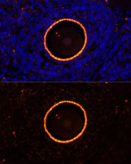 IHC-P analysis of rat oophoroma tissue using GTX64579 ZP2 antibody. Blue : DAPI Dilution : 1:100