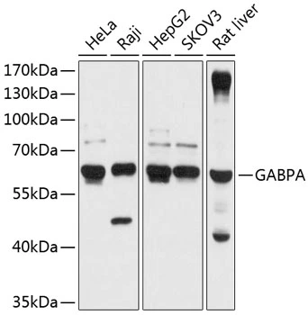 WB analysis of various sample lysates using GTX64581 GABPA antibody. Dilution : 1:1000 Loading : 25microg per lane WB analysis of various sample lysates using GTX64581 GABPA antibody. Dilution : 1:1000 Loading : 25microg per lane