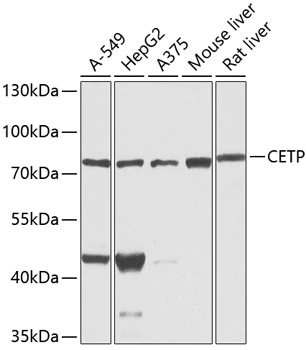 WB analysis of various sample lysates using GTX64582 CETP antibody. Dilution : 1:1000 Loading : 25microg per lane WB analysis of various sample lysates using GTX64582 CETP antibody. Dilution : 1:1000 Loading : 25microg per lane