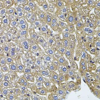 IHC-P analysis of mouse liver tissue using GTX64582 CETP antibody.