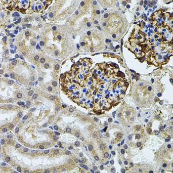 IHC-P analysis of rat kidney tissue using GTX64582 CETP antibody.