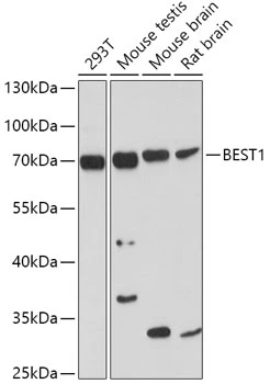WB analysis of various sample lysates using GTX64583 Bestrophin 1 antibody. Dilution : 1:1000 Loading : 25microg per lane WB analysis of various sample lysates using GTX64583 Bestrophin 1 antibody. Dilution : 1:1000 Loading : 25microg per lane