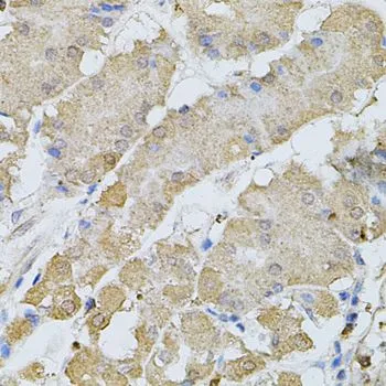 IHC-P analysis of human stomach tissue using GTX64583 Bestrophin 1 antibody. Dilution : 1:100