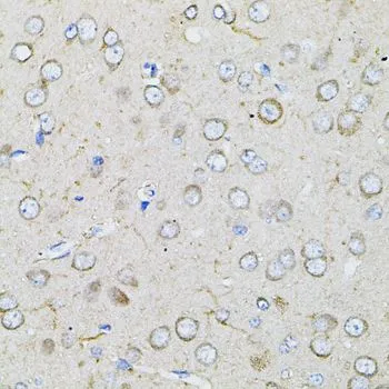 IHC-P analysis of rat brain tissue using GTX64583 Bestrophin 1 antibody. Dilution : 1:100